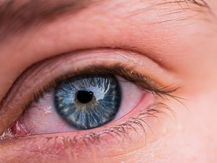 Капли для глаз от раздражения и покраснения